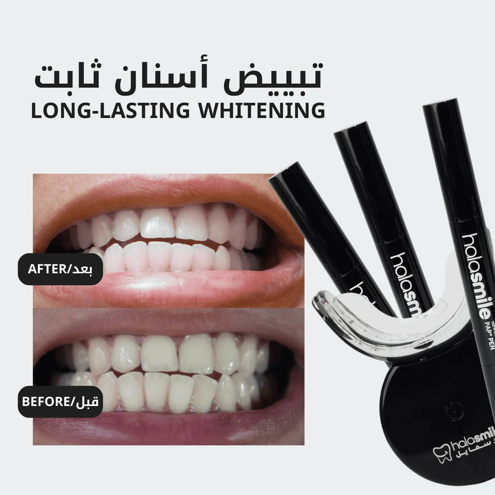 The Teeth Whitening Device