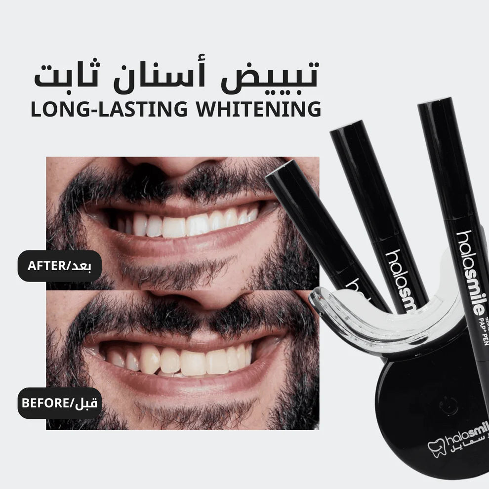 The Teeth Whitening Device