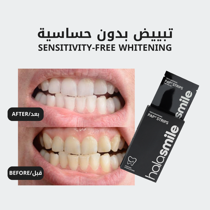 The Teeth Whitening Strips
